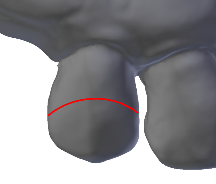 Datei:Klammerverlauf 2.png