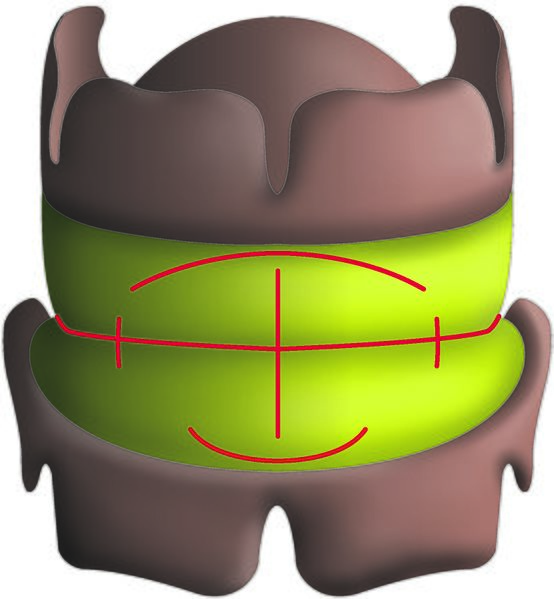 Datei:Bissschablonen front linien.jpg