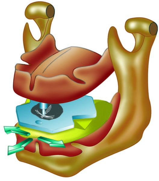 Datei:Pfeilwinkelregistrat farbig.jpg